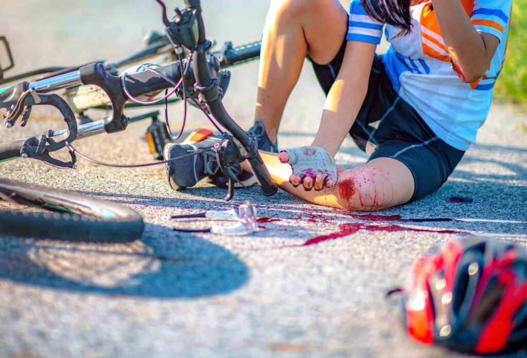 photo of a cyclist who fell down and is holding her knee, which is covered in blood, and in the background is a bicycle with a broken front wheel