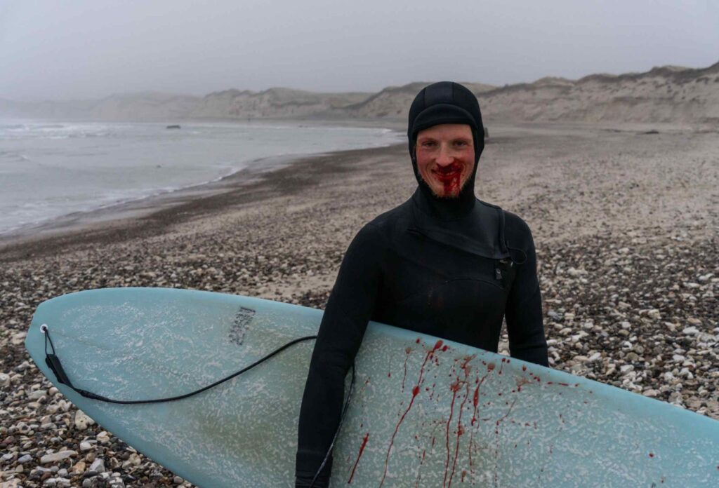 A surfer with a crushed nose in a black wetsuit smiles and holds his blue board, which shows drops of blood on it